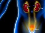 5 tín hiệu cảnh báo thận suy yếu
