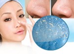 Bí quyết trị mụn đầu đen hiệu quả