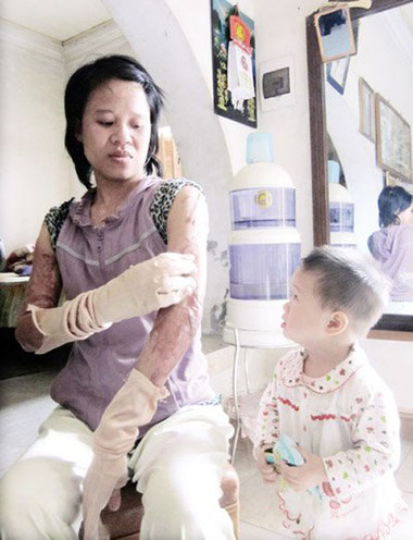 Vụ hỏa hoạn bất ngờ 1 Vụ hỏa hoạn bất ngờ 1