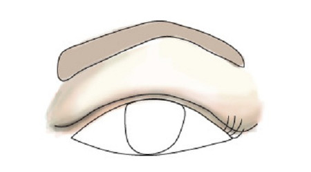 Bầu mắt trùm 1 Bầu mắt trùm 1