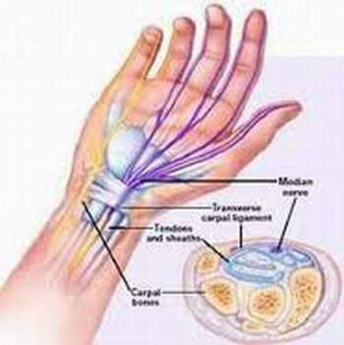 Nguyên nhân và cách phòng ngừa chứng co cơ đột ngột 1 Nguyên nhân và cách phòng ngừa chứng co cơ đột ngột 1