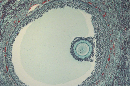 3. Tế bào trứng trong nang 1 3. Tế bào trứng trong nang 1