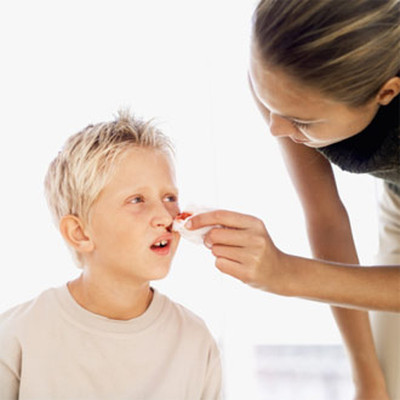 Cách 2 1 Lấy bông gòn ra khỏi mũi khi máu đã ngừng chảy.