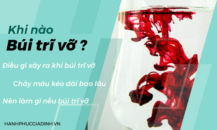 Khi nào búi trĩ vỡ? 1 Khi nào búi trĩ vỡ? 1