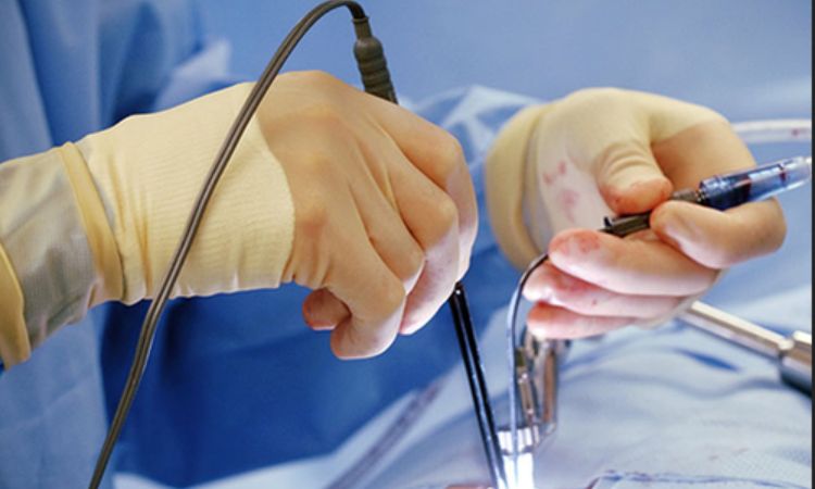 Phương pháp phẫu thuật trĩ 1 Phương pháp phẫu thuật trĩ 1