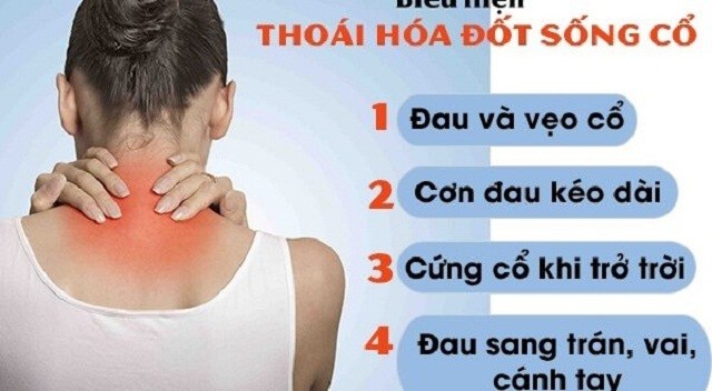 Triệu chứng của bệnh thoái hóa đốt sống cổ 1 Triệu chứng của bệnh thoái hóa đốt sống cổ 1