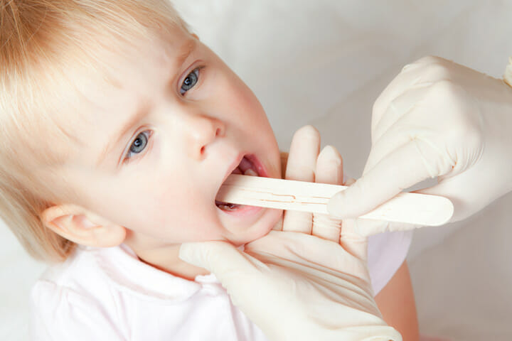 Trẻ bị viêm họng - Khi nào cần gặp bác sĩ? 1