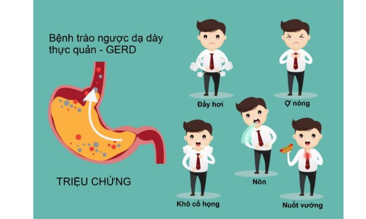 Trào ngược dạ dày thực quản có triệu chứng gì? 1 Trào ngược dạ dày thực quản có triệu chứng gì? 1