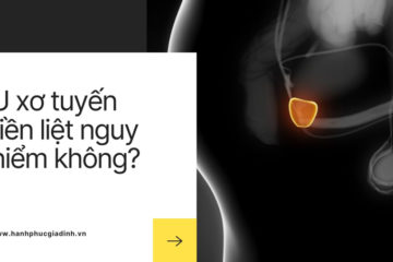 Bệnh u xơ tiền liệt tuyến: Nguy hiểm hay không? Bệnh u xơ tiền liệt tuyến: Nguy hiểm hay không?