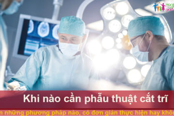 cat-tri-bang-phuong-phap-nao-co-don-gian-khong