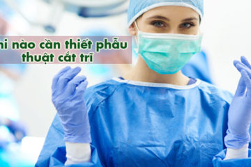khi-nao-can-phau-thuat-cat-tri