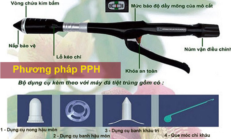 2. Phương pháp cắt trĩ PPH 1 2. Phương pháp cắt trĩ PPH 1
