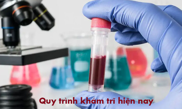 Quy trình thực hiện khám trĩ ra sao? 2 Quy trình thực hiện khám trĩ ra sao? 2