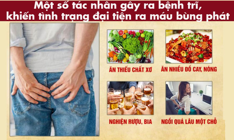 Do bệnh trĩ 1 Do bệnh trĩ 1