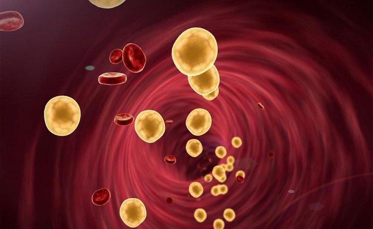 Rối loạn mỡ máu là gì? 1 Rối loạn mỡ máu là gì? 1