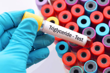 Triglyceride tăng cao phải làm sao? Triglyceride tăng cao phải làm sao?