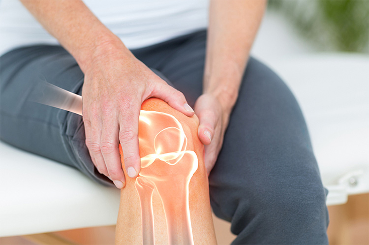 Thoái hóa khớp gối có nguy hiểm không? 1 Thoái hóa khớp gối có nguy hiểm không? 1