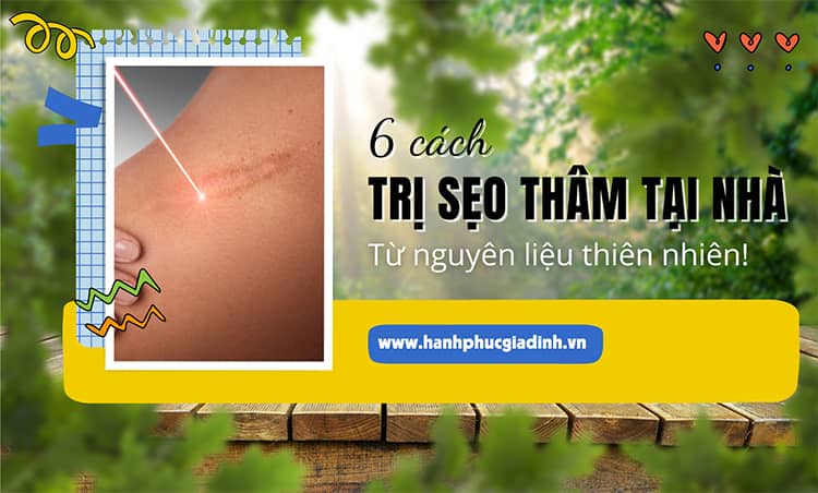 6 cach trị sẹo thâm tại nhà