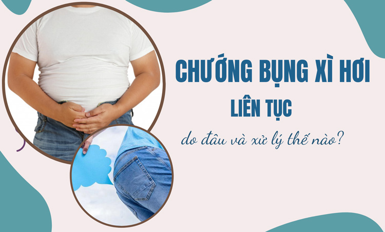 Chướng bụng xì hơi liên tục do đâu? Xử lý thế nào? 1