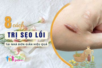8 cách trị sẹo lồi tại nhà đơn giản, hiệu quả dành riêng cho bạn 8 cách trị sẹo lồi tại nhà đơn giản, hiệu quả dành riêng cho bạn