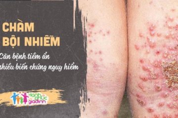 Cham bội nhiễm biến chứng nguy hiểm