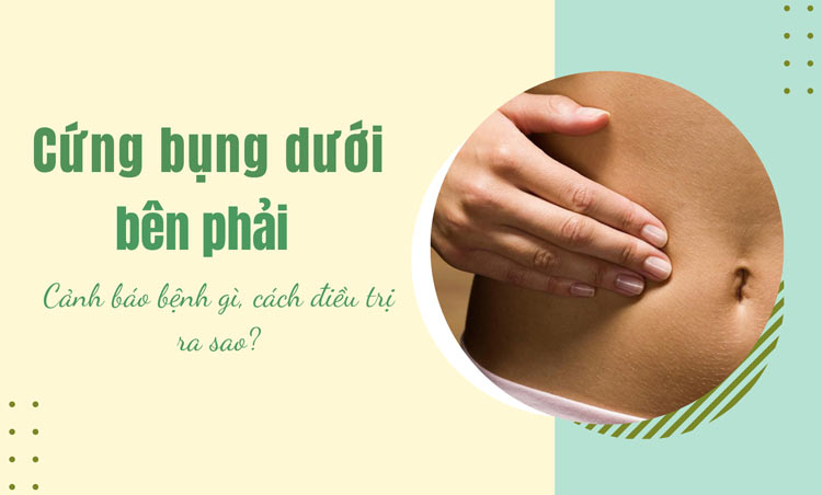 Cứng bụng dưới bên phải là bệnh gì? Cách điều trị thế nào? 1 Cứng bụng dưới bên phải là bệnh gì? Cách điều trị thế nào? 1