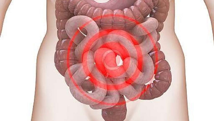 Bệnh đại tràng co thắt 1