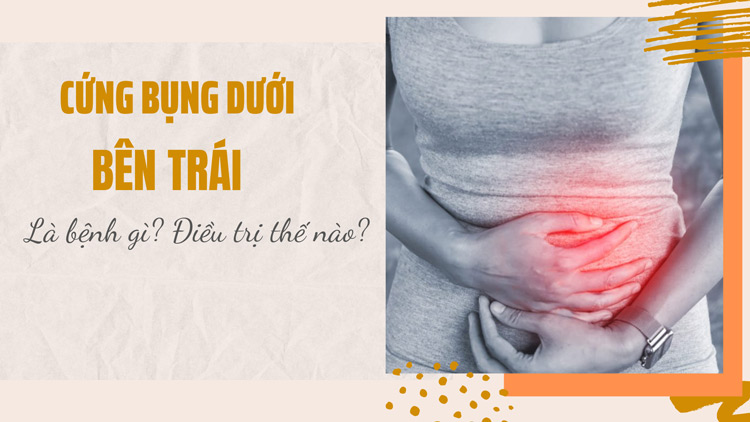 Cứng bụng dưới bên trái là bệnh gì? Cách điều trị ra sao? 1