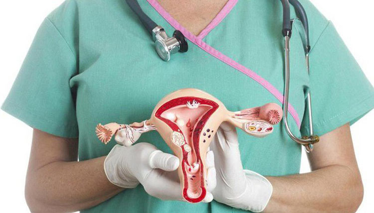 Ung thư buồng trứng 1