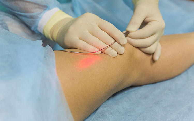 Phẫu thuật bằng Laser 1 Phẫu thuật bằng Laser 1