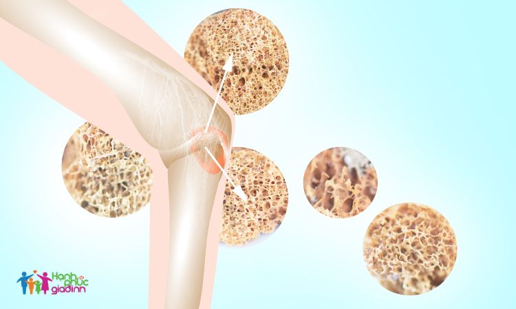 Thiếu hụt estrogen gây ảnh hưởng thế nào đến sức khỏe phụ nữ? 1