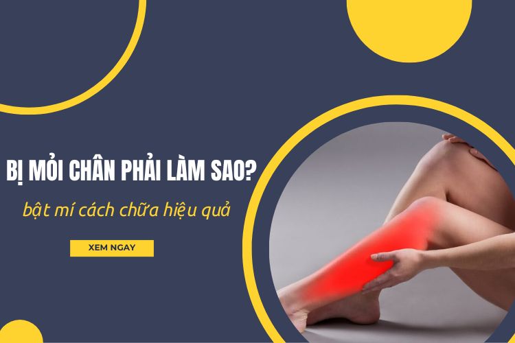 Bị mỏi chân phải làm sao? Bật mí cách chữa hiệu quả 1